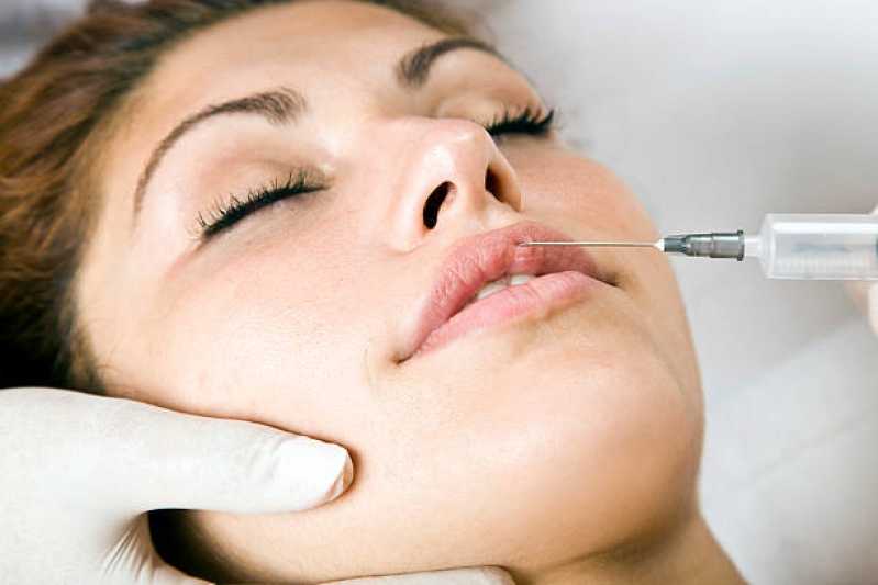 Aplicação de Botox Bruxismo Clínica Nilópolis - Aplicação de Botox Facial