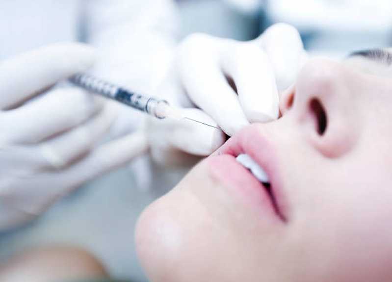 Aplicação de Botox Bruxismo São Gonçalo - Aplicação de Botox na Boca