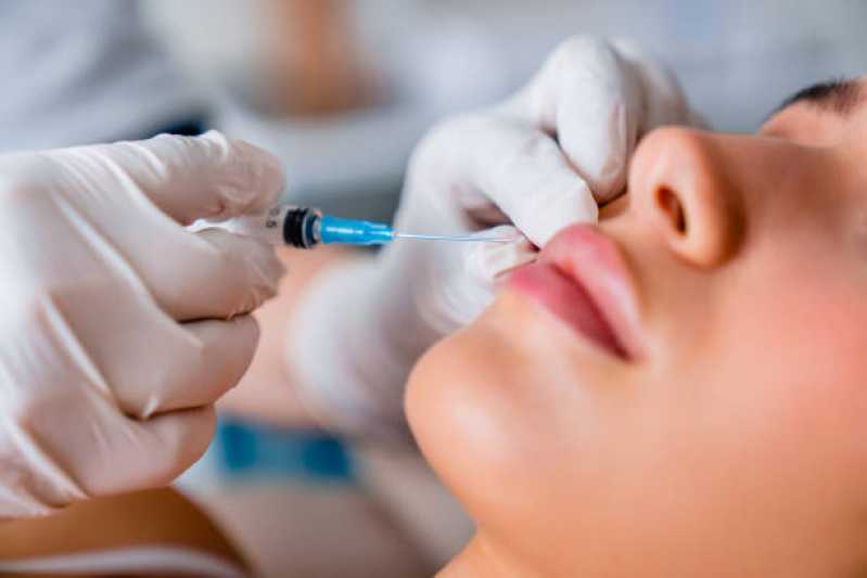 Aplicação de Botox Facial Clínica Santa Teresa - Aplicação de Botox na Boca