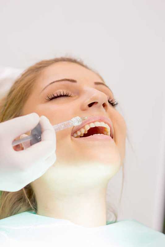 Aplicação de Botox Facial Seropédica - Aplicação de Botox no Rosto