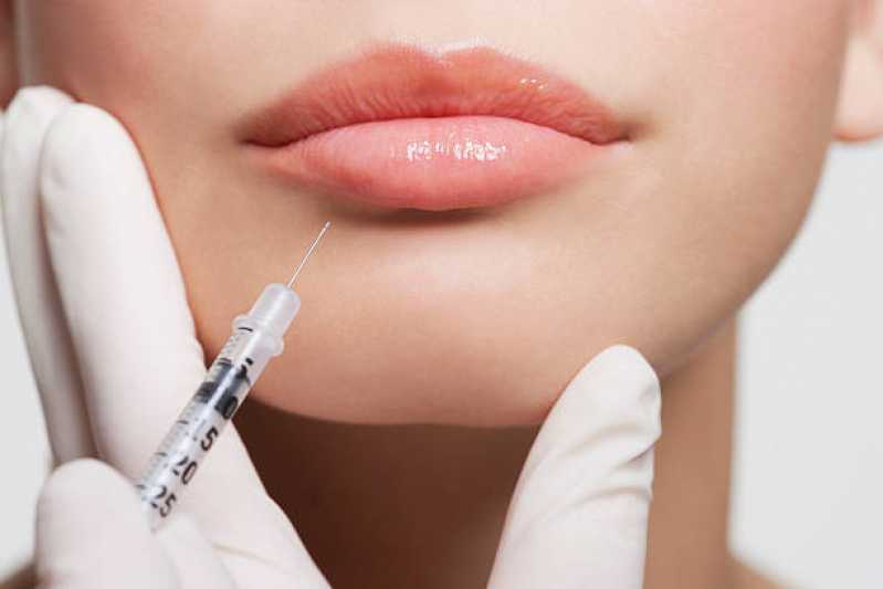 Aplicação de Botox Labial Centro - Aplicação de Botox na Testa