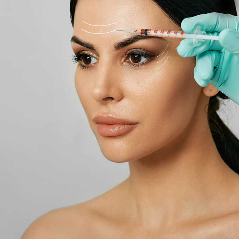 Aplicação de Botox no Rosto Clínica Vidigal - Aplicação de Botox Facial