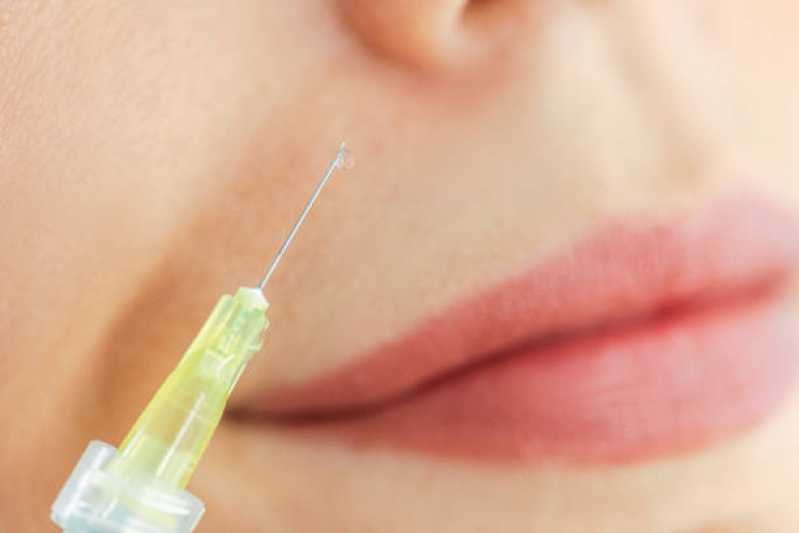 Aplicação de Botox para Bruxismo Clínica Barra Mansa - Aplicação de Botox na Testa