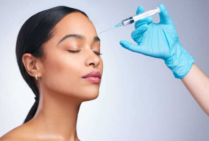 Aplicação de Botox Testa Clínica Rio Comprido - Aplicação de Botox no Rosto
