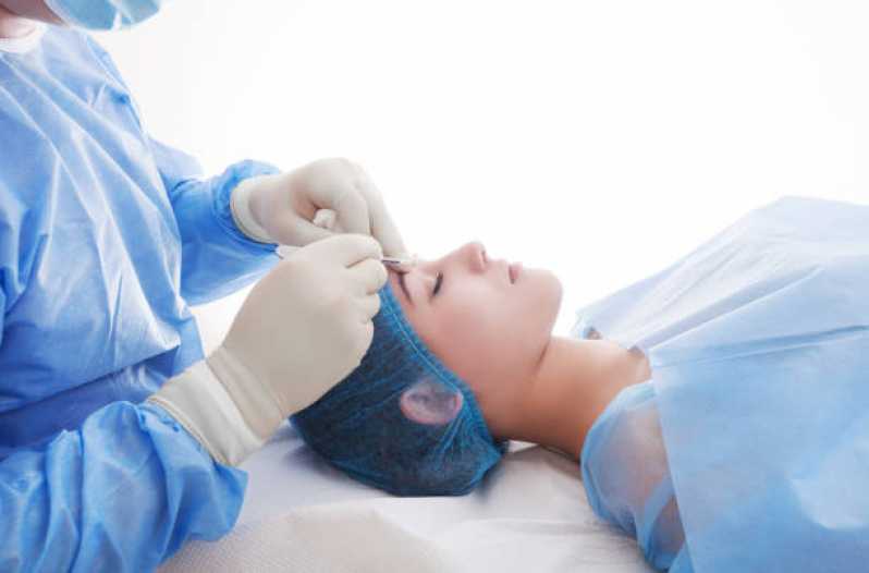 Cirurgia Blefaroplastia Marcar Centro - Blefaroplastia Jato de Plasma
