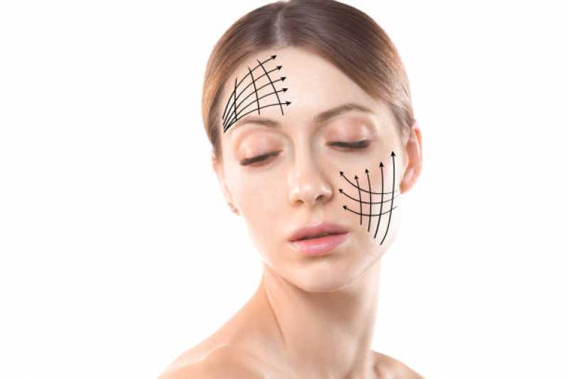 Cirurgia de Lifting de Sobrancelhas Rio Comprido - Cirurgia de Mini Lifting Facial