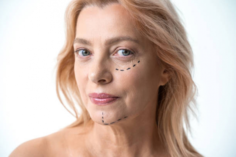 Cirurgia Dermatológica do Rosto Marcar Saúde - Cirurgia Dermatológica Plastica Facial
