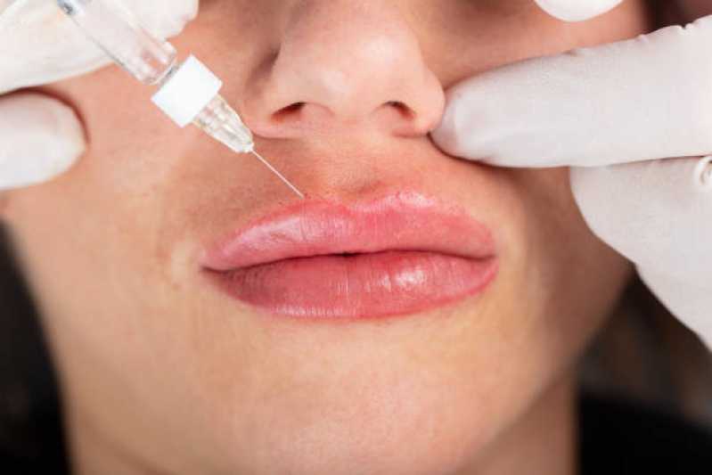 Clínica Especializada em Aplicação de Botox Bruxismo Tijuca - Aplicação de Botox Facial