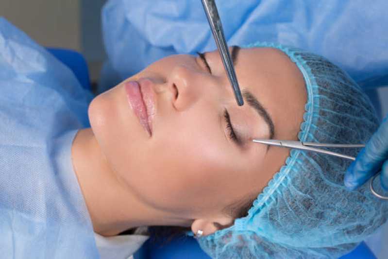Clínica Que Faz Cirurgia de Pálpebras Gamboa - Blefaroplastia com Plasma