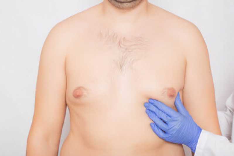 Mamoplastia Bilateral Bacabeira - Mamoplastia com Gordura