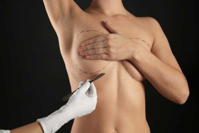 Mamoplastia Redutora com Lipo nas Laterais Clínica Mangueira - Mamoplastia de Redução com Prótese