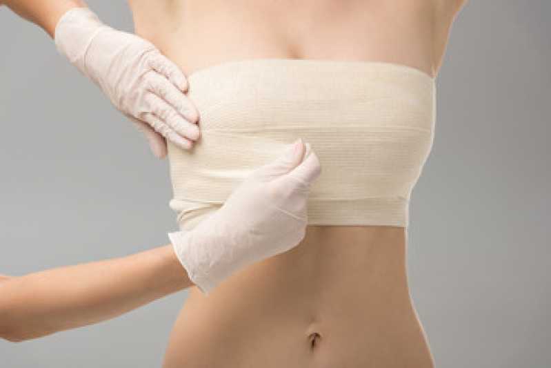 Mamoplastia Redutora com Prótese Clínica Piraí - Mamoplastia de Redução com Prótese