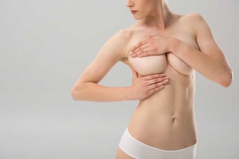 Mamoplastia Redutora Masculina Laranjeiras - Mamoplastia de Redução com Prótese