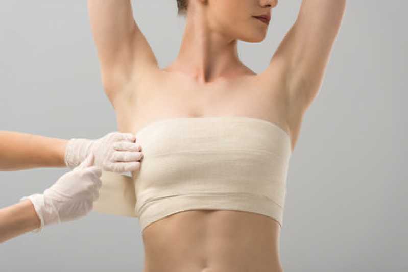 Mamoplastia Redutora Mulher Cidade Nova - Mamoplastia Redutora Cirurgia
