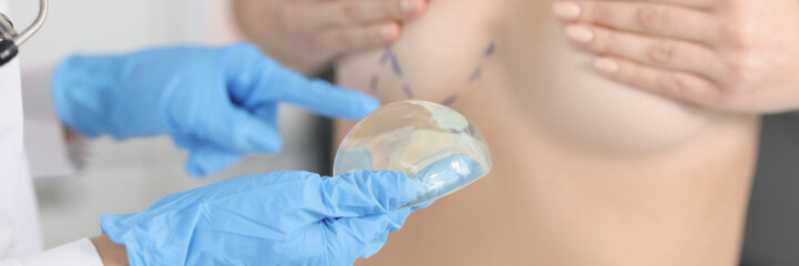 Onde Faz Mamoplastia Periareolar Seropédica - Mamoplastia Feminina
