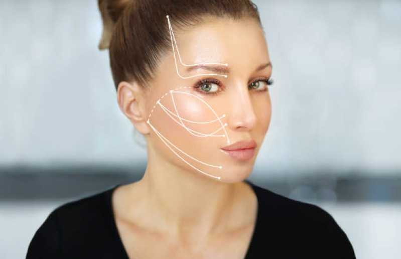 Onde Fazer Cirurgia de Mini Lifting Facial Ipanema - Cirurgia de Mini Lifting Facial