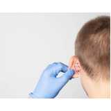 cirurgia orelha Saúde