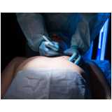 clínica especializada em cirurgia ginecomastia Armação dos Búzios