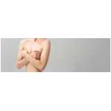 clínica especializada em mamoplastia redutora com implante de silicone Estácio