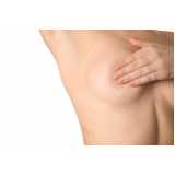 clínica especializada em mamoplastia redutora com lipo nas laterais Nova Friburgo