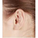 clínica que faz cirurgia de orelha rasgada Cidade Nova