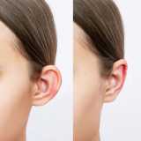 clínica que faz cirurgia orelha rasgada Centro