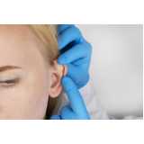 clínica que faz cirurgia orelha Centro