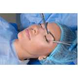 clínica que faz cirurgia pálpebras Seropédica