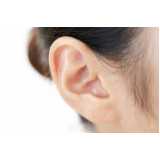 clínica que faz cirurgia para orelha rasgada Mesquita