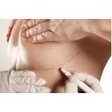mamoplastia de redução com prótese Piraí