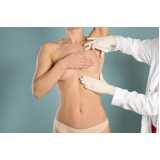 mamoplastia para diminuição clínicas Santa Teresa