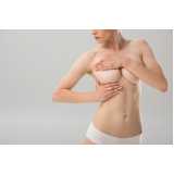 mamoplastia redutora bilateral clínica Paquetá